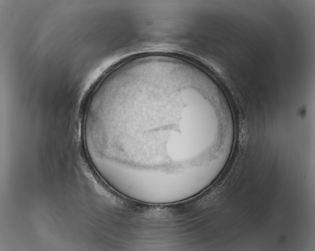 X0000115681414200912031409