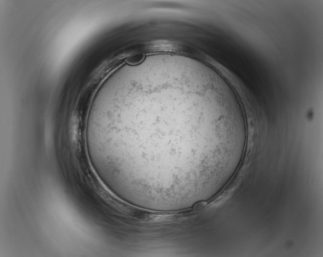 X0000115681438200912031409