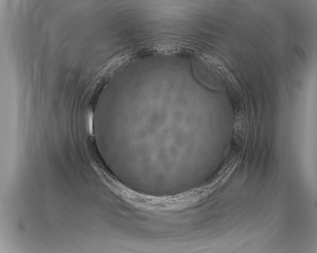 X0000115690046200911121317