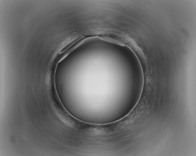 X0000115690250200911121314