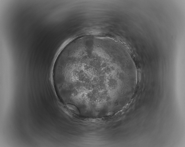 X0000115690147200911191121