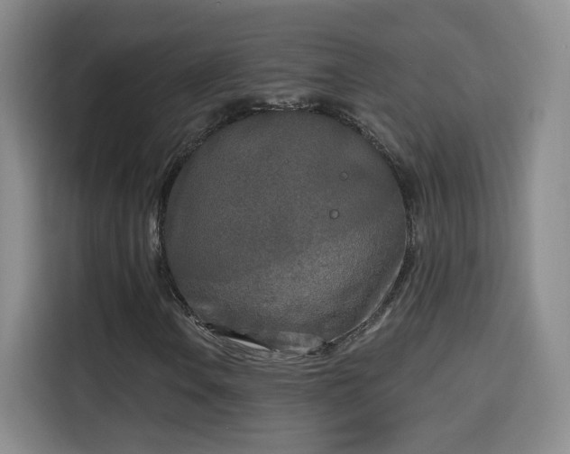 X0000115691106200911191108