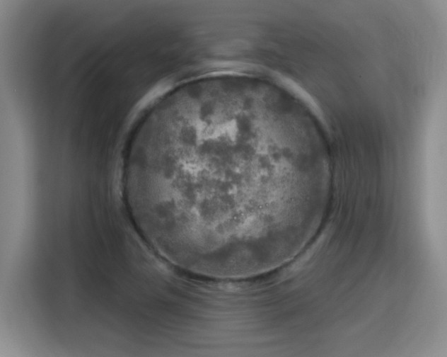 X0000115691411200911191105