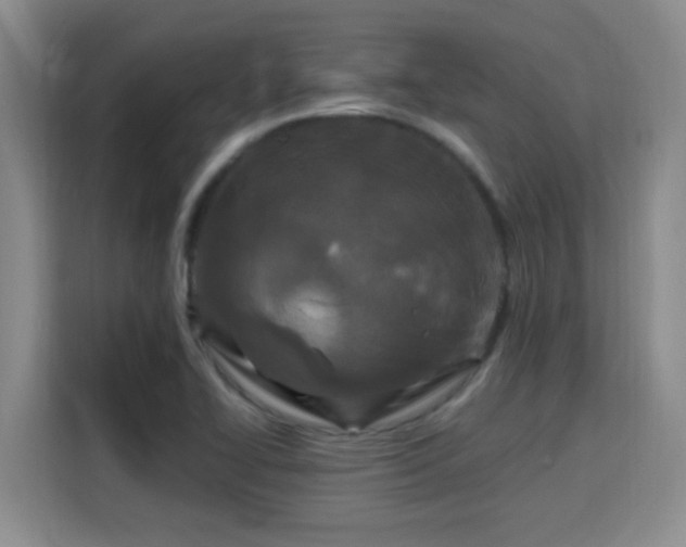 X0000115691414200911191105