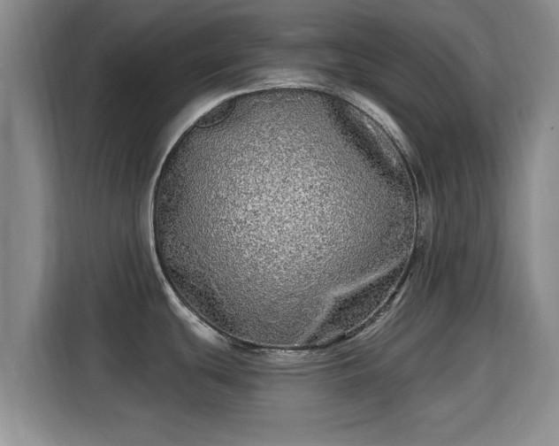 X0000115691439200911191105