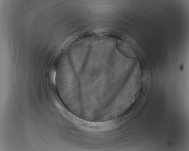 X0000115690046200912031452