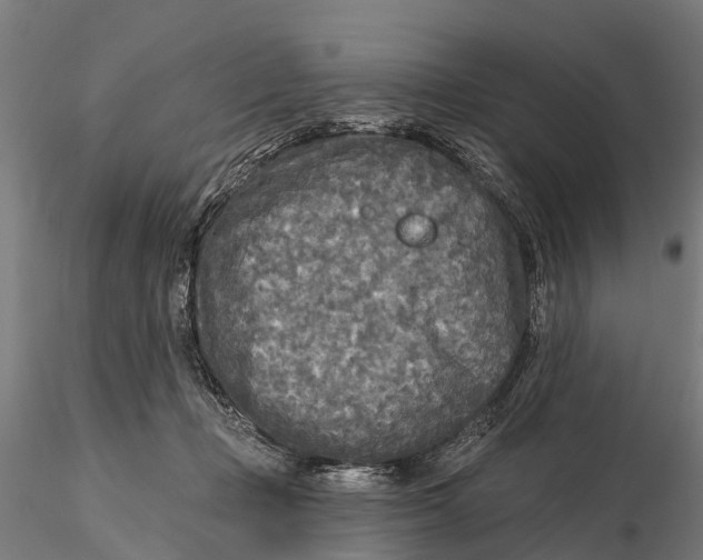 X0000115690365200912031448