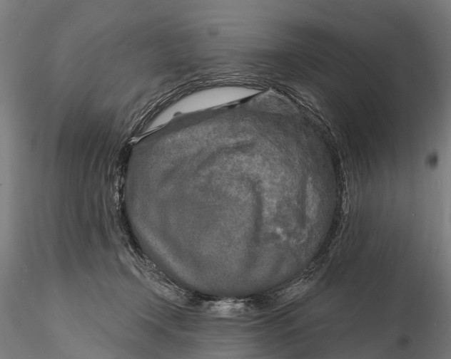 X0000115690366200912031448