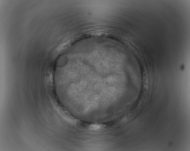 X0000115690375200912031448