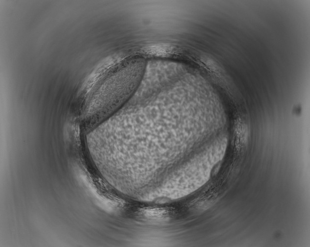 X0000115690500200912031446