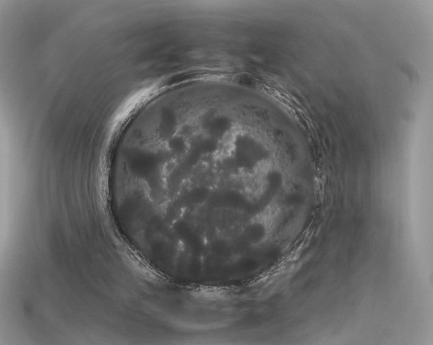 X0000115700149200911121411