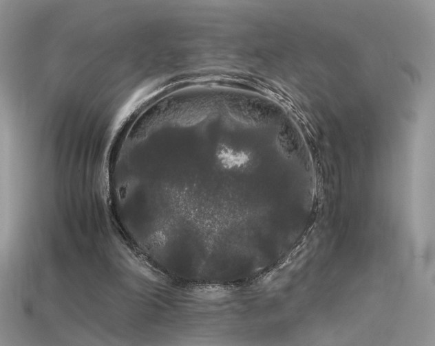 X0000115700198200911121411