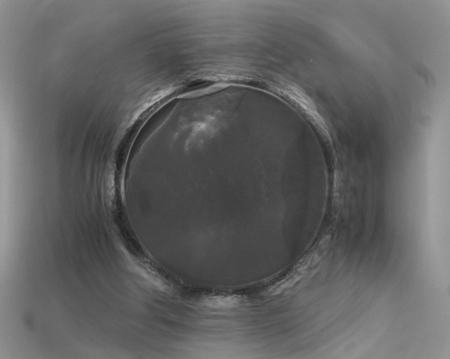 X0000115700202200911121411