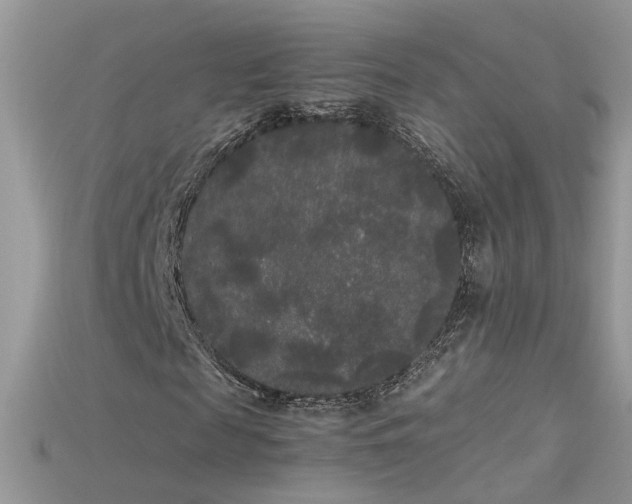 X0000115700817200911121402