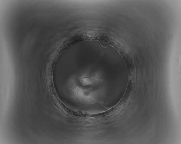 X0000115701009200911191225