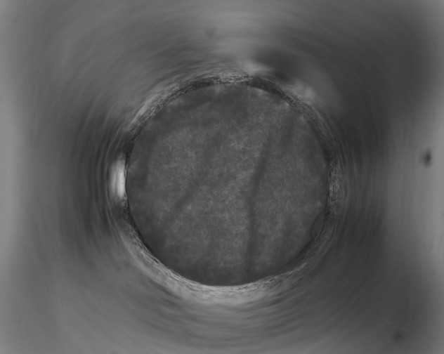 X0000115700046200912031515