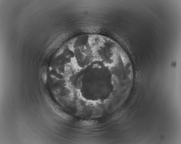 X0000115700069200912031515