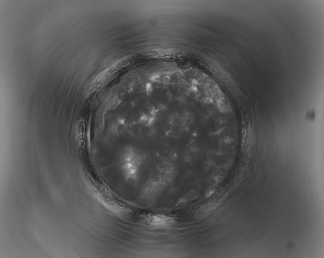 X0000115700165200912031513