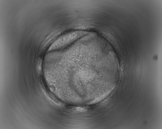 X0000115700166200912031513