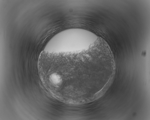 X0000115700175200912031513