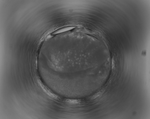 X0000115700349200912031510