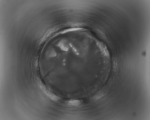 X0000115700357200912031510