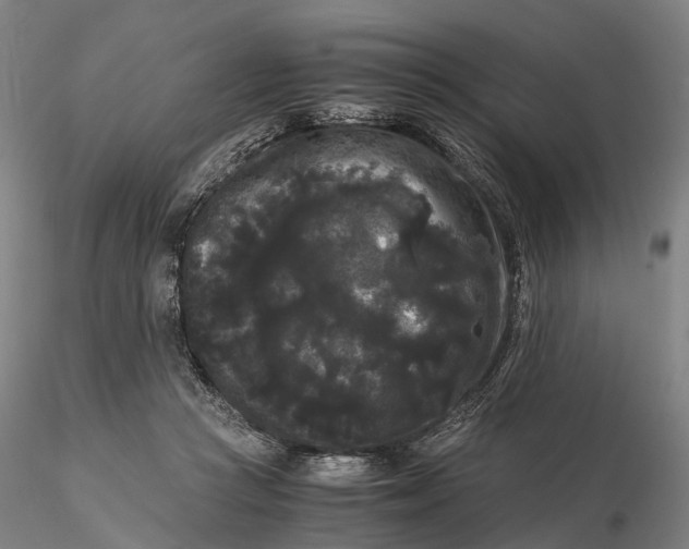 X0000115700361200912031511