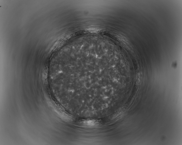 X0000115700365200912031511