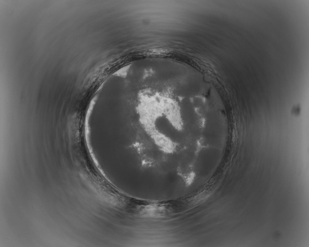 X0000115700366200912031511