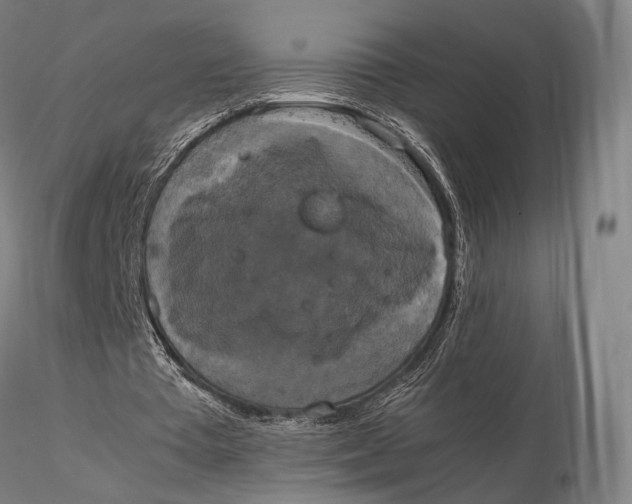 X0000115700385200912031510