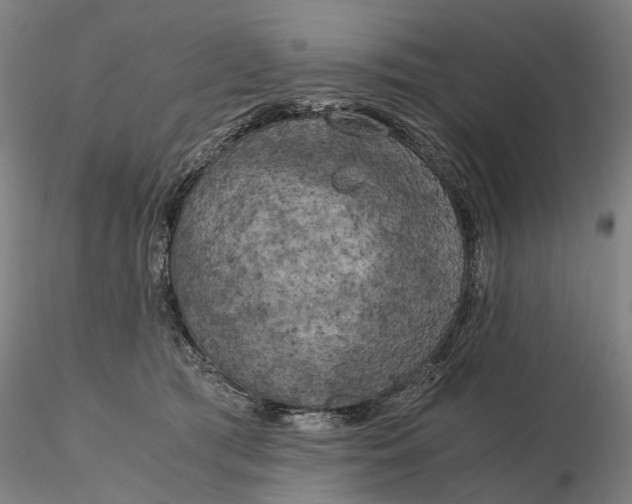 X0000115700417200912031510