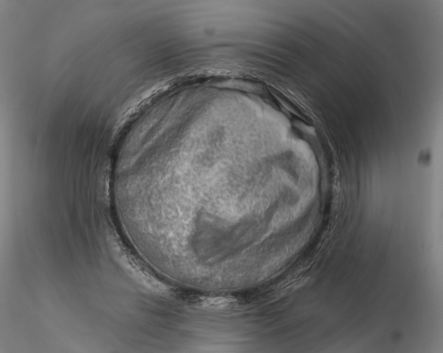 X0000115700446200912031509