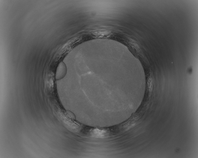 X0000115700570200912031508