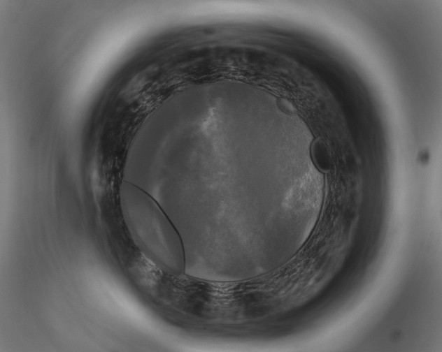 X0000115700766200912031505