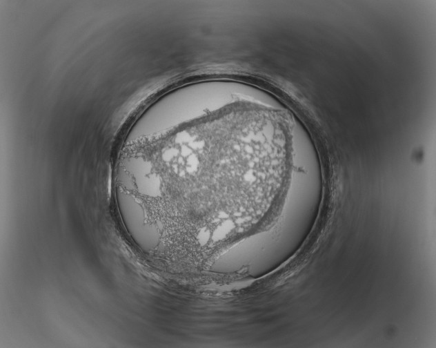 X0000115701221200912031457