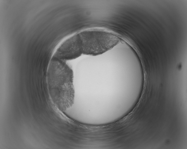 X0000115701436200912031455