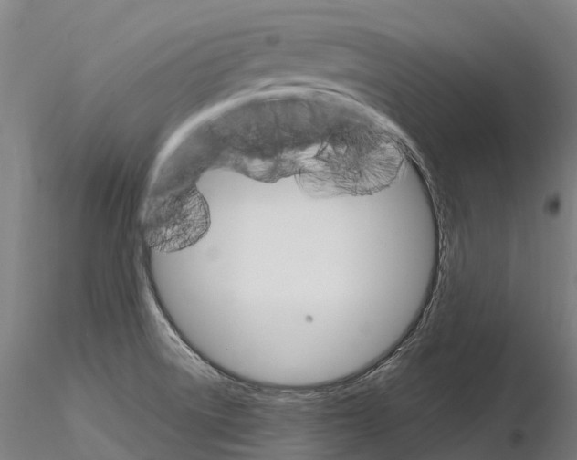 X0000115701522200912031453