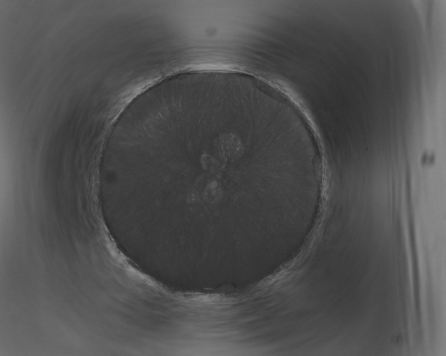 X0000115700385200912241527