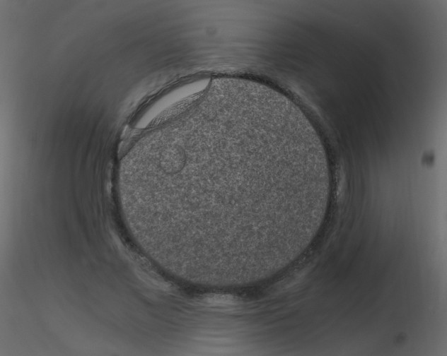 X0000115700685200912241523