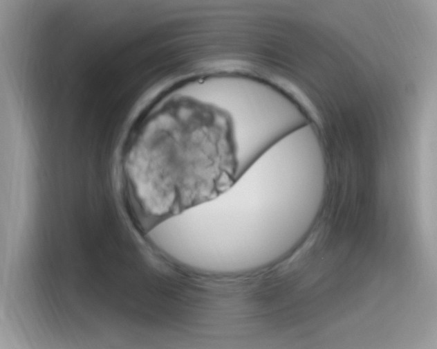 X0000115711031200911120959