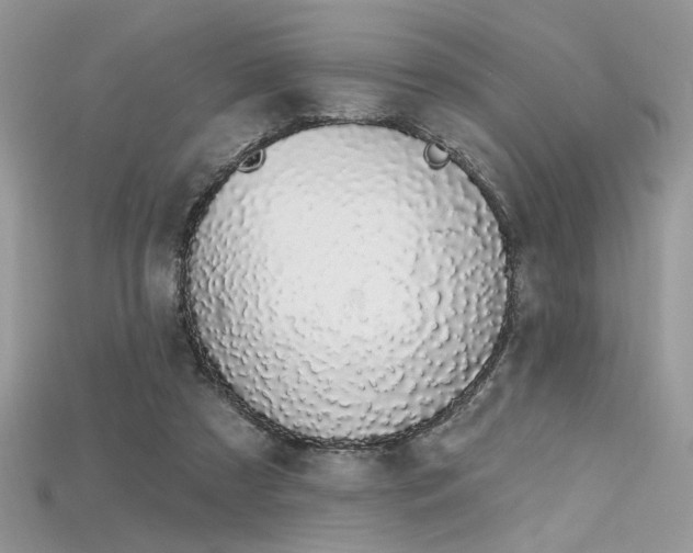 X0000115710305200911121431