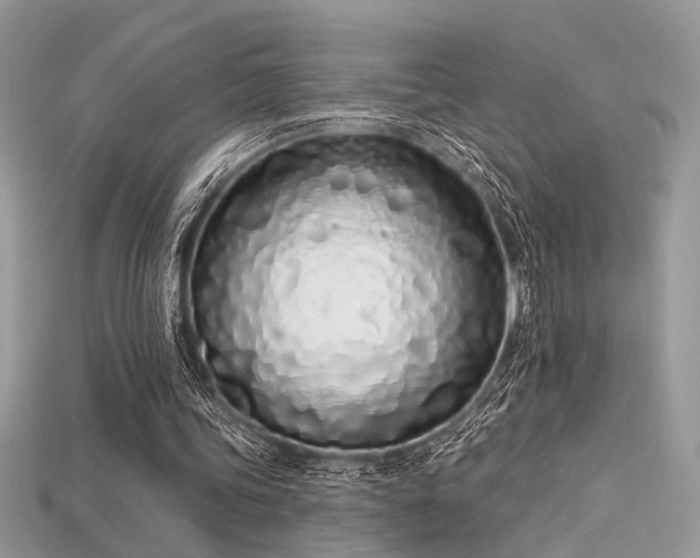 X0000115710339200911121430