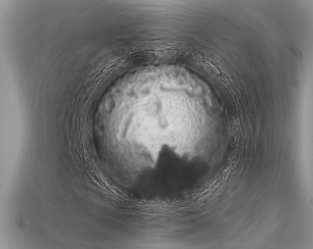 X0000115711009200911121420