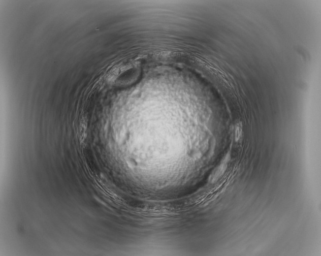 X0000115711011200911121420