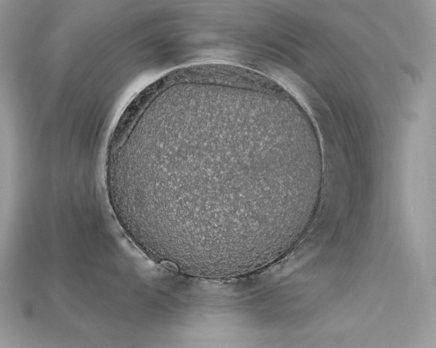 X0000115711104200911121420