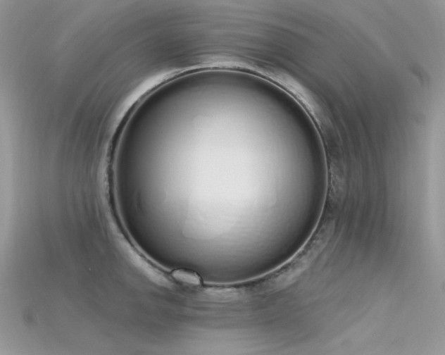 X0000115711142200911121420