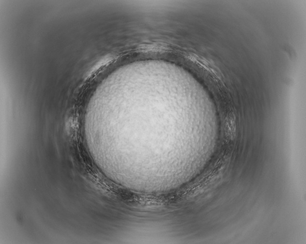 X0000115711254200911121418