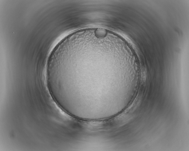 X0000115711294200911121417