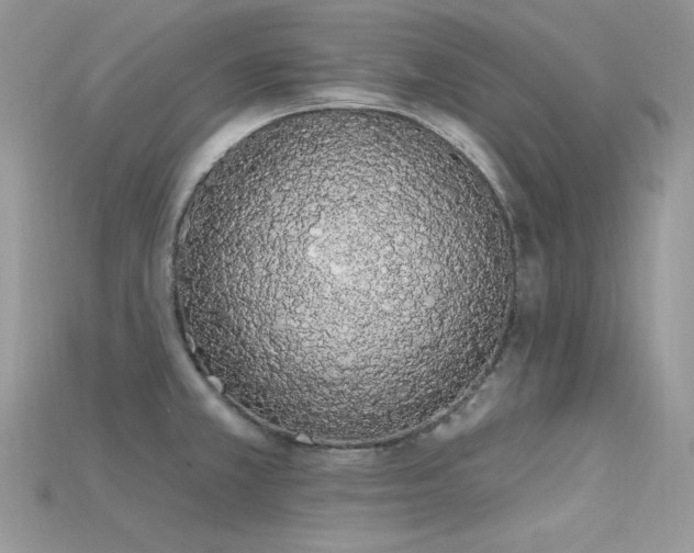 X0000115711381200911121416