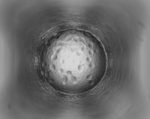 X0000115711397200911121415